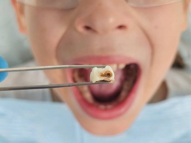 Best Dentist for Dental Trauma  in West Hazleton, PA